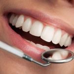 Фторирование зубов, как один из методов профилактики кариеса