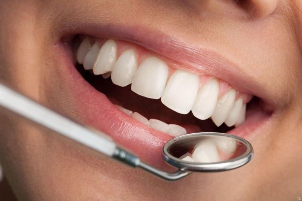 Фторирование зубов, как один из методов профилактики кариеса